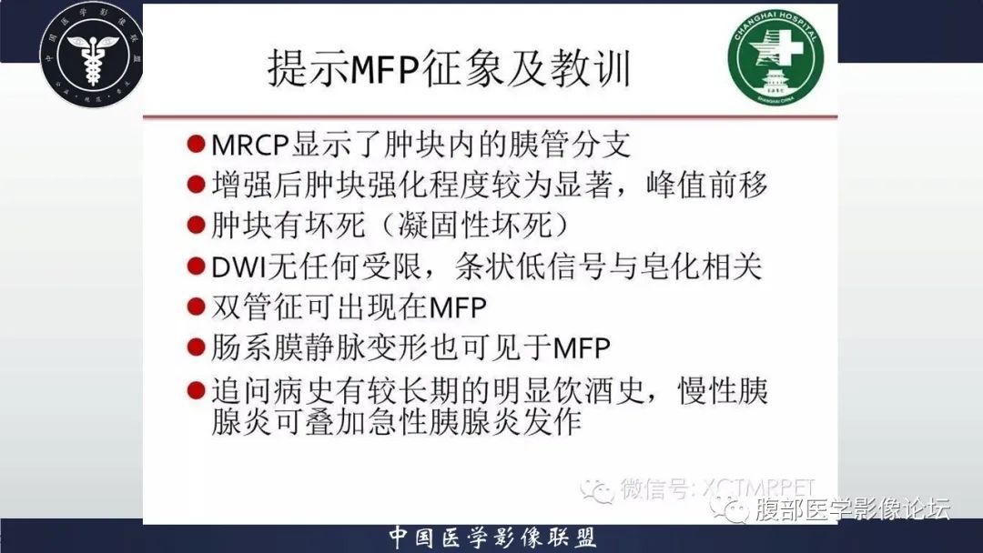 影像PPT - 【病例】肿块型胰腺炎1例CT影像诊断-21