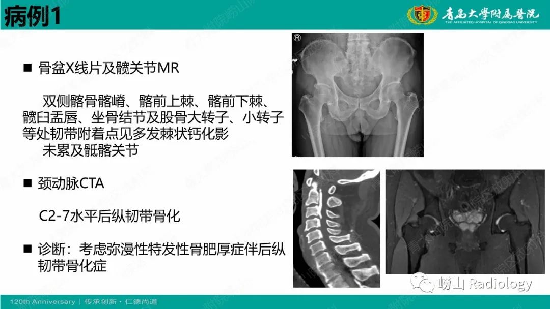 影像PPT - 【病例】弥漫性特发性骨肥厚症 VS 强直性脊柱炎-8
