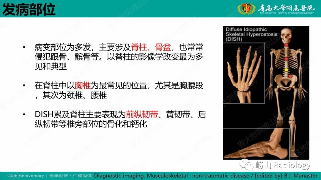影像PPT - 【病例】弥漫性特发性骨肥厚症 VS 强直性脊柱炎-11