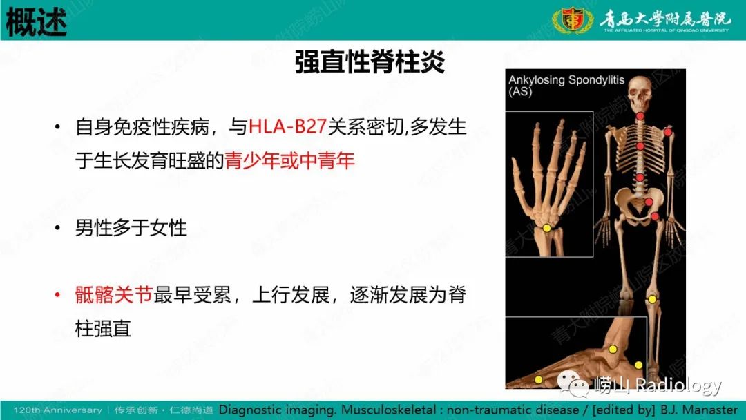 影像PPT - 【病例】弥漫性特发性骨肥厚症 VS 强直性脊柱炎-22
