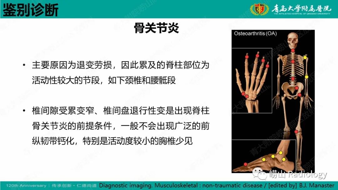 影像PPT - 【病例】弥漫性特发性骨肥厚症 VS 强直性脊柱炎-33