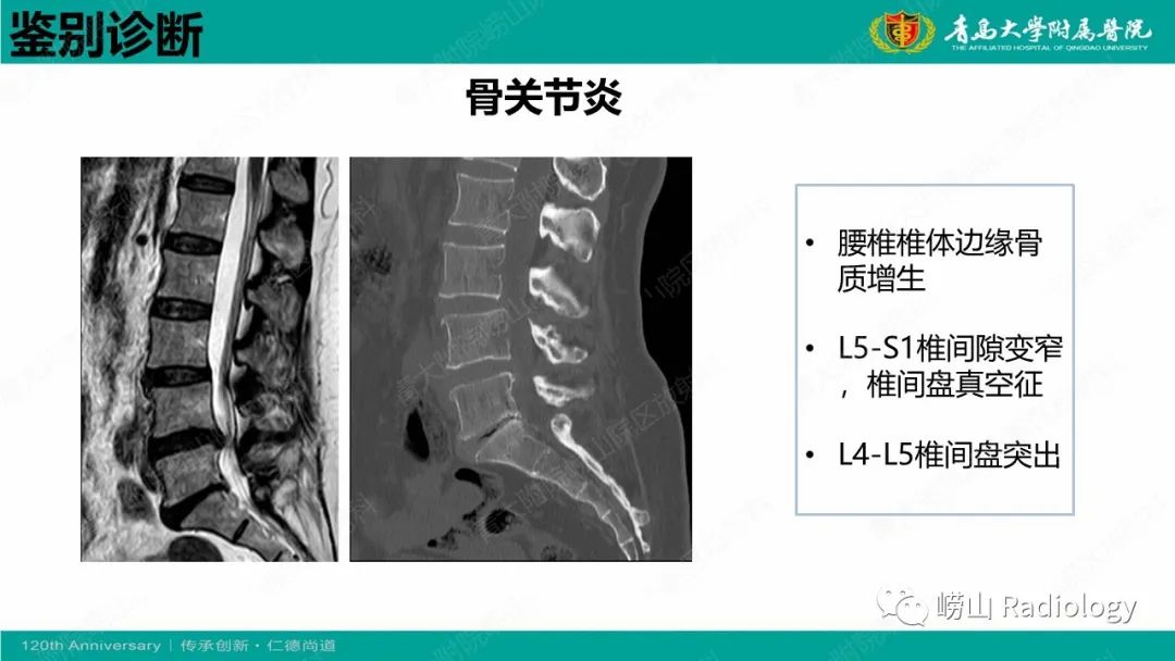 影像PPT - 【病例】弥漫性特发性骨肥厚症 VS 强直性脊柱炎-34