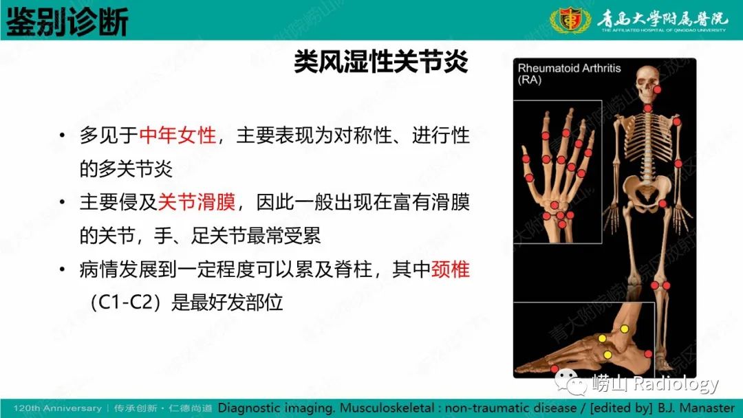 影像PPT - 【病例】弥漫性特发性骨肥厚症 VS 强直性脊柱炎-29