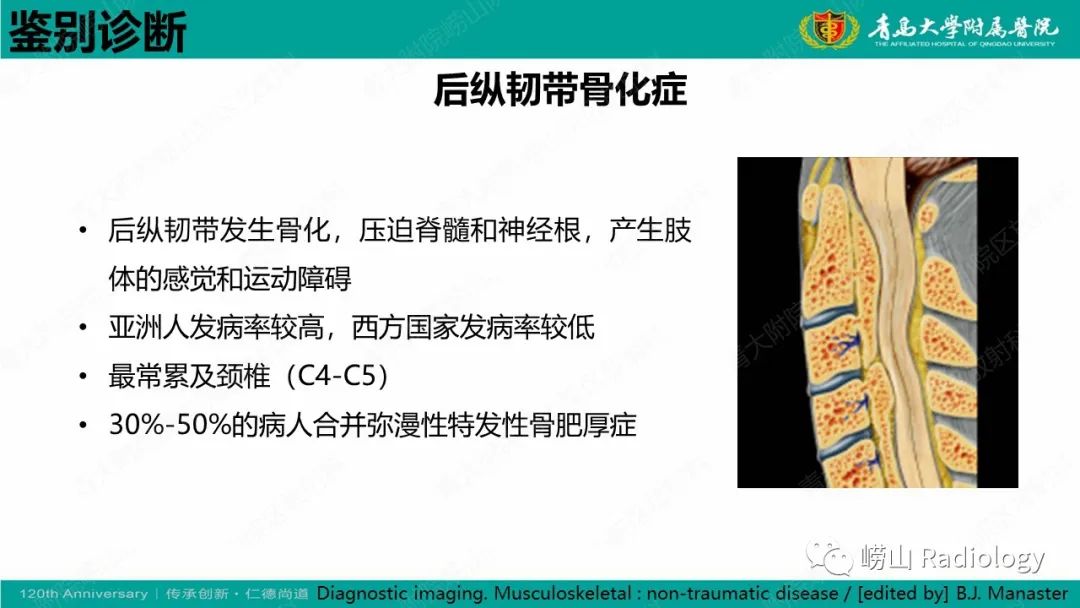 影像PPT - 【病例】弥漫性特发性骨肥厚症 VS 强直性脊柱炎-35