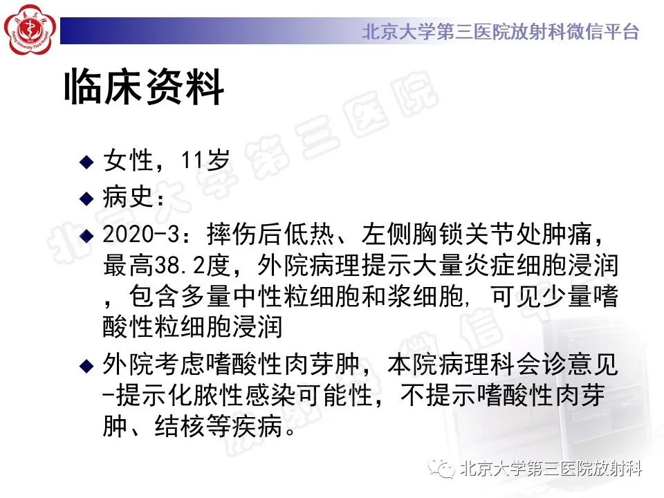 影像PPT - 【PPT】慢性复发性多灶性骨髓炎-2