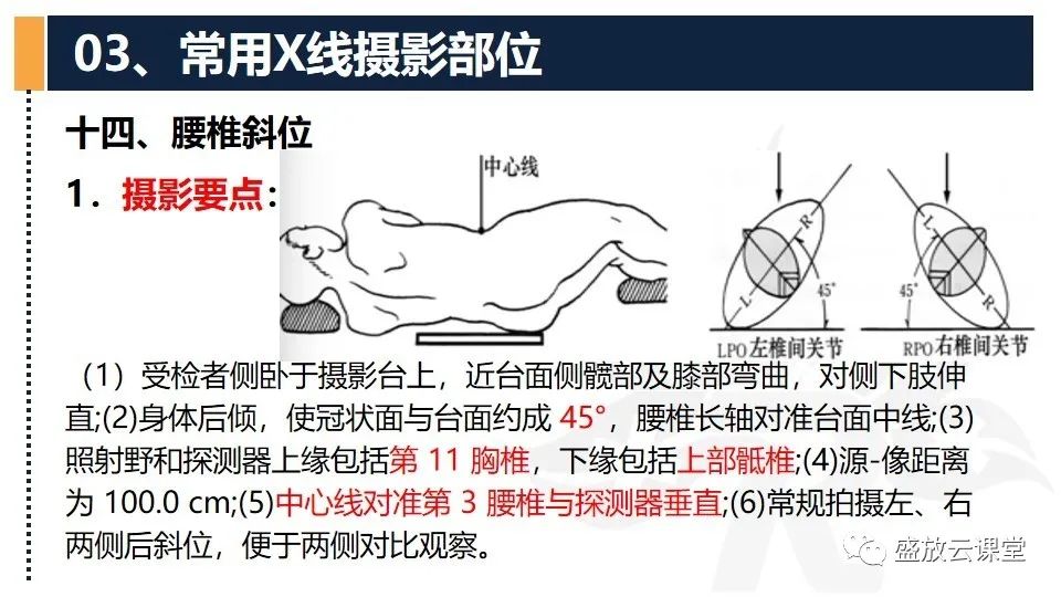 影像PPT - 【PPT】数字X线摄影检查（二）-3