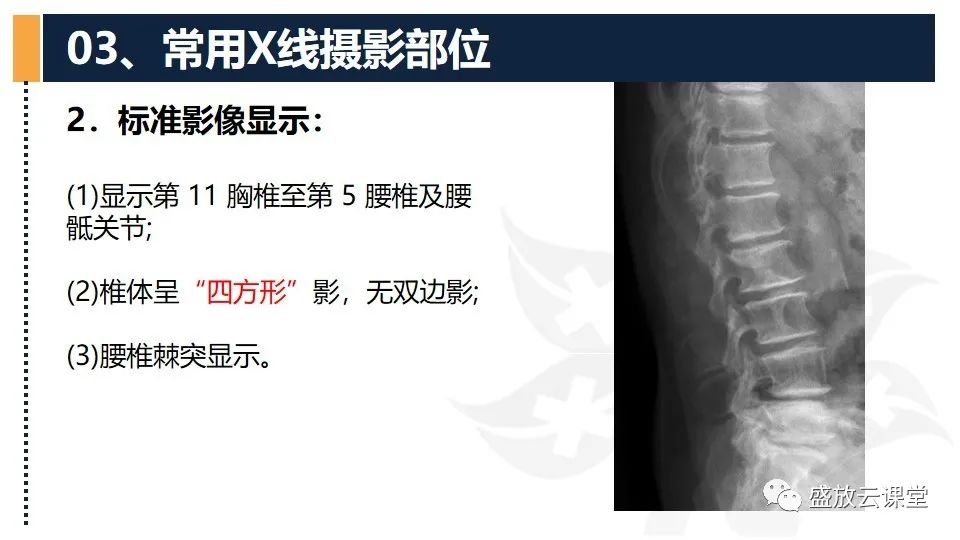 影像PPT - 【PPT】数字X线摄影检查（二）-8