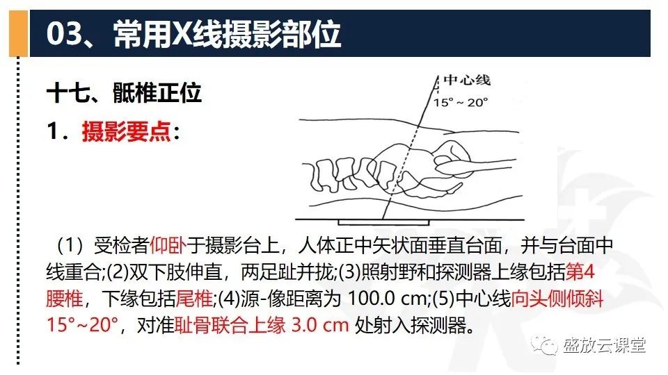 影像PPT - 【PPT】数字X线摄影检查（二）-9