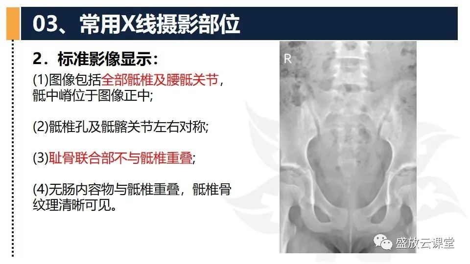 影像PPT - 【PPT】数字X线摄影检查（二）-10