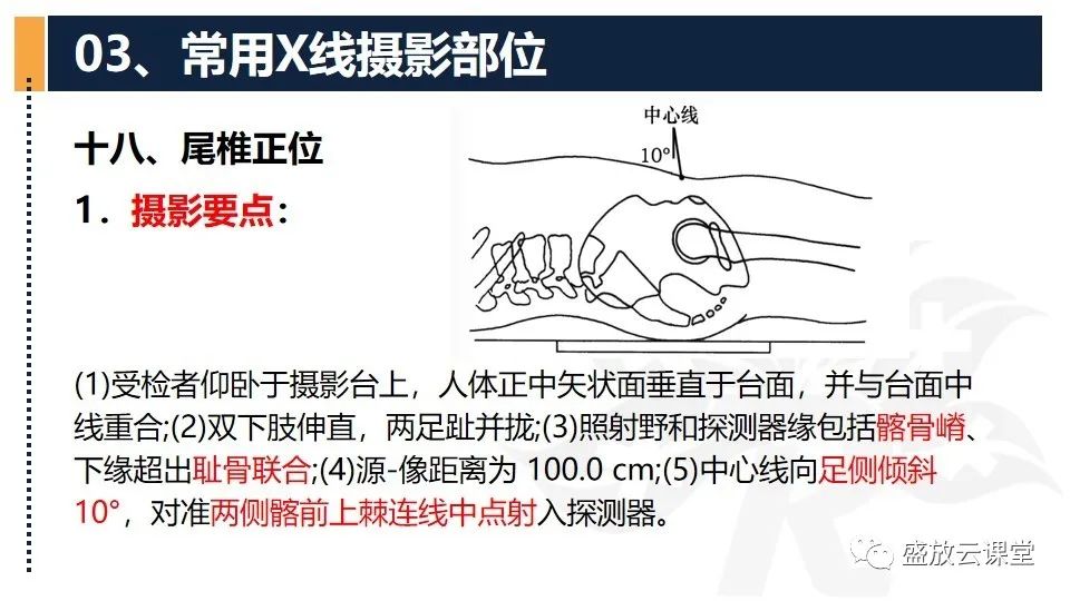 影像PPT - 【PPT】数字X线摄影检查（二）-11