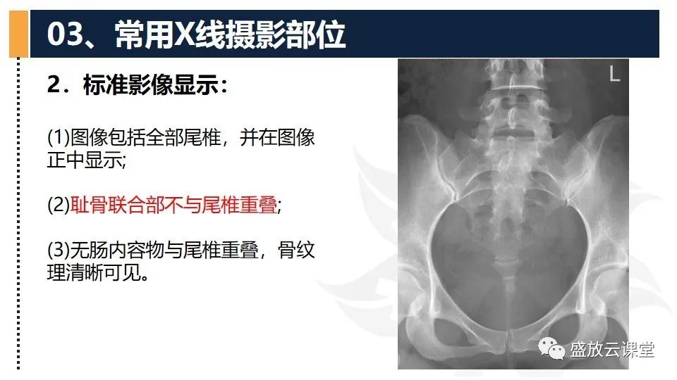 影像PPT - 【PPT】数字X线摄影检查（二）-12