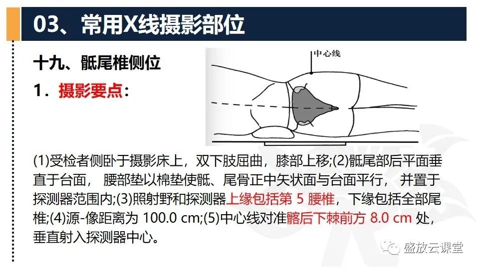 影像PPT - 【PPT】数字X线摄影检查（二）-13
