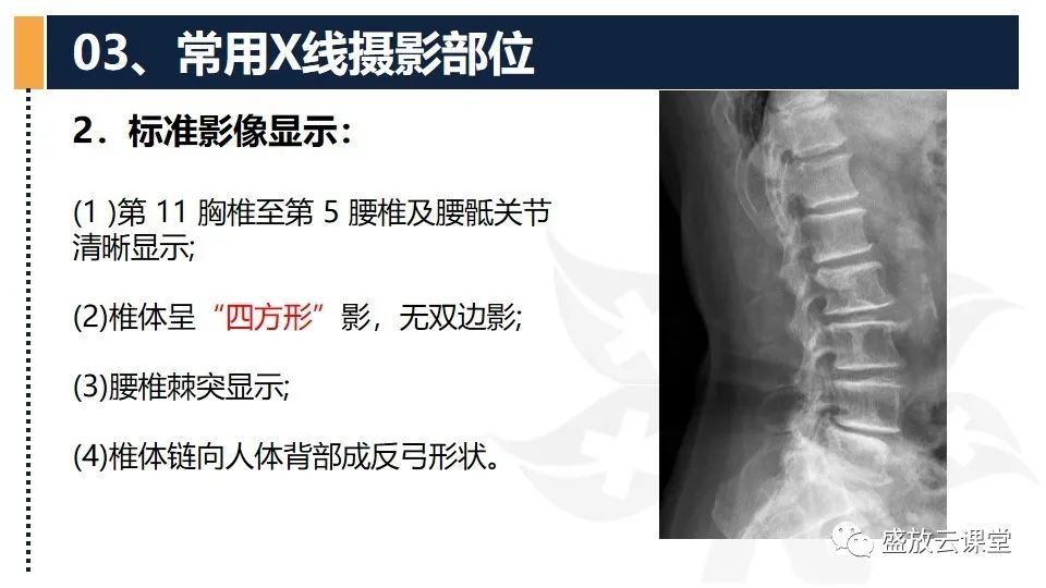 影像PPT - 【PPT】数字X线摄影检查（二）-6