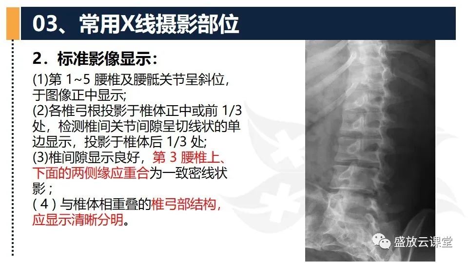 影像PPT - 【PPT】数字X线摄影检查（二）-4