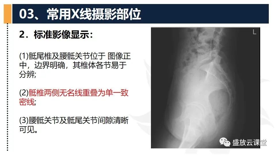 影像PPT - 【PPT】数字X线摄影检查（二）-14