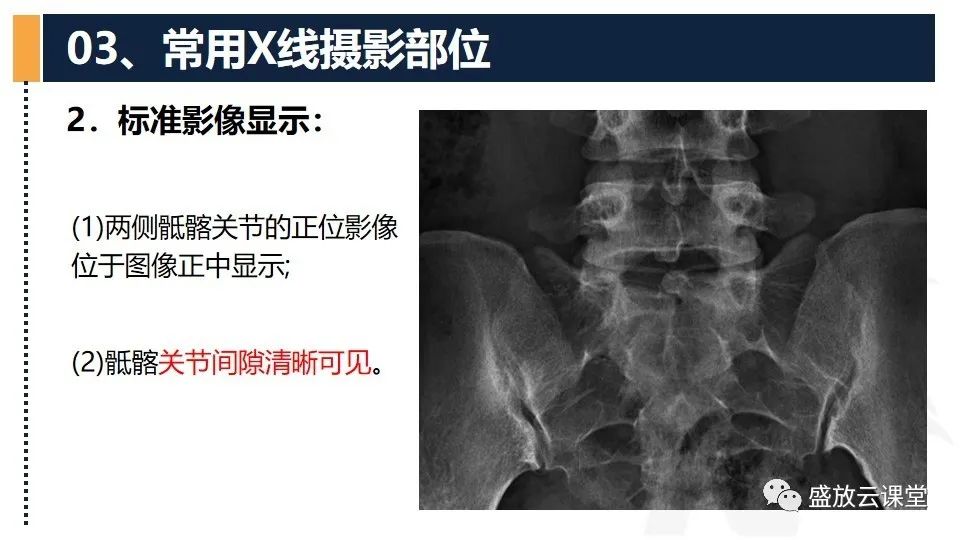 影像PPT - 【PPT】数字X线摄影检查（二）-16
