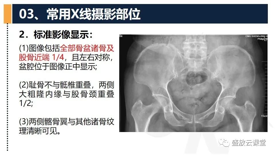 影像PPT - 【PPT】数字X线摄影检查（二）-20