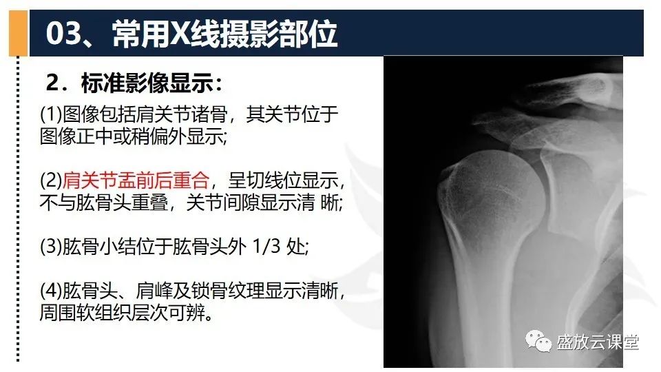 影像PPT - 【PPT】数字X线摄影检查（二）-22