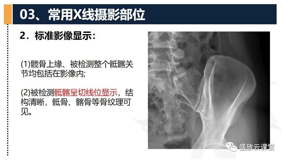影像PPT - 【PPT】数字X线摄影检查（二）-18