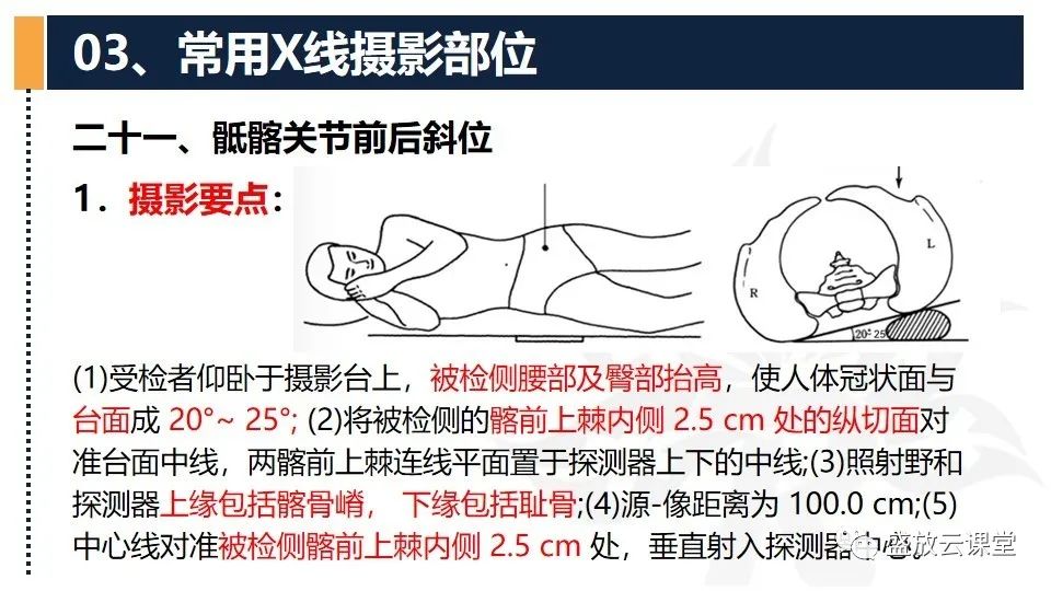 影像PPT - 【PPT】数字X线摄影检查（二）-17