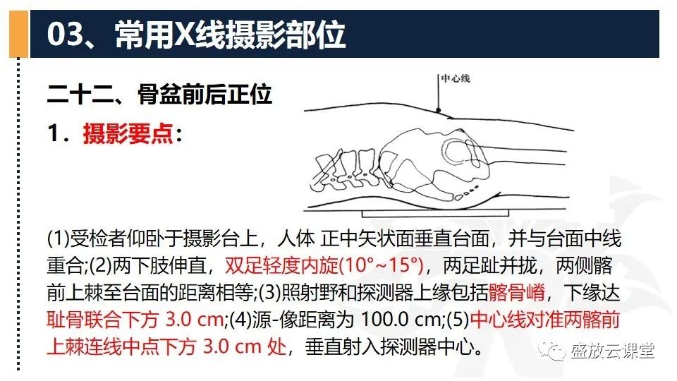 影像PPT - 【PPT】数字X线摄影检查（二）-19
