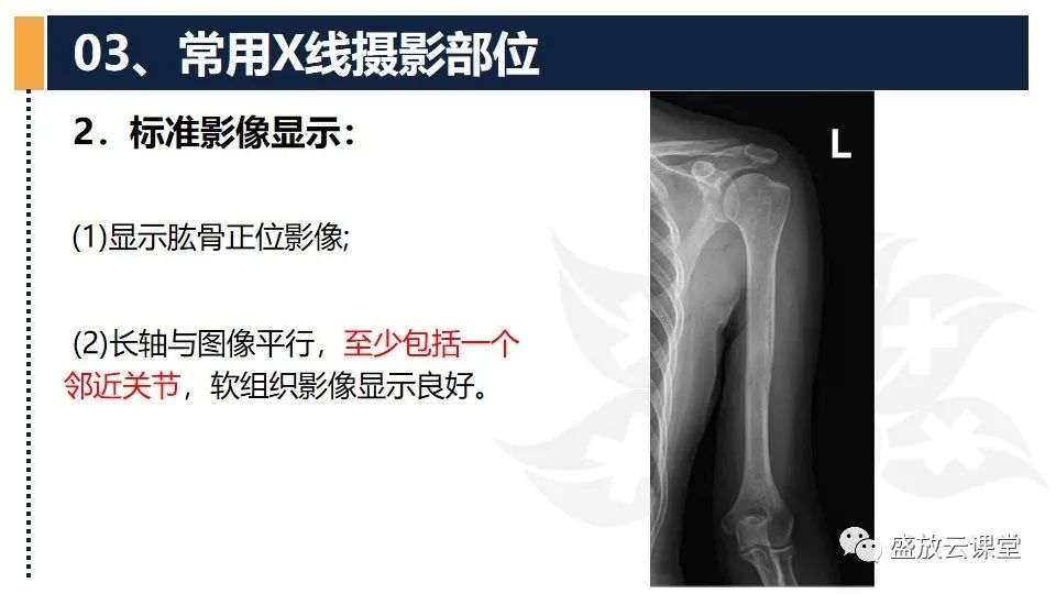 影像PPT - 【PPT】数字X线摄影检查（二）-26