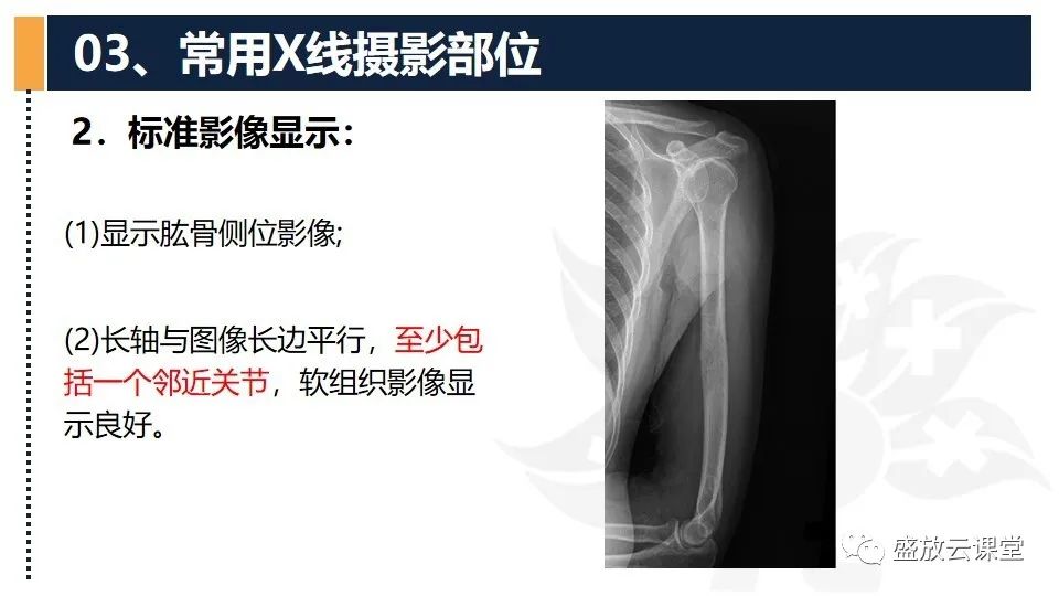 影像PPT - 【PPT】数字X线摄影检查（二）-28