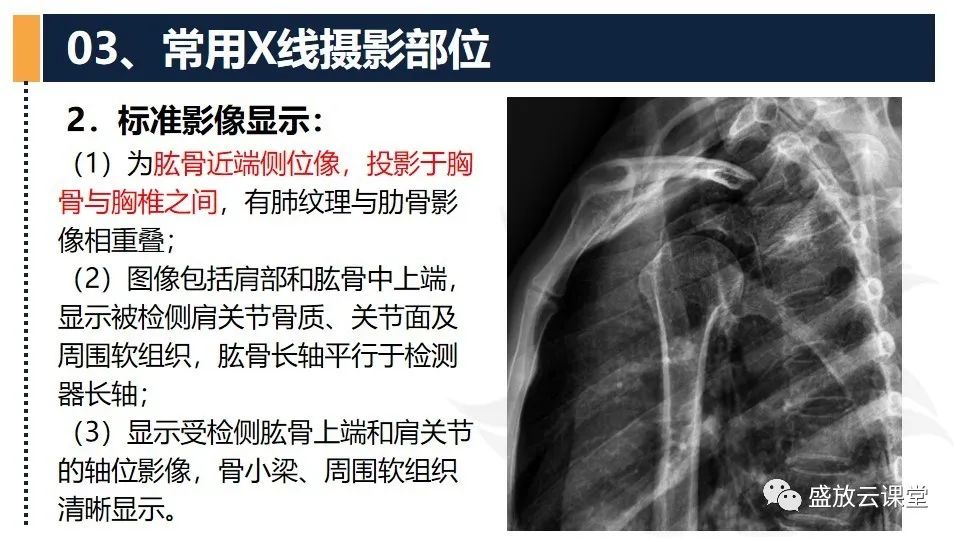 影像PPT - 【PPT】数字X线摄影检查（二）-24