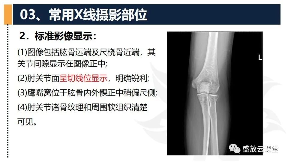 影像PPT - 【PPT】数字X线摄影检查（二）-30