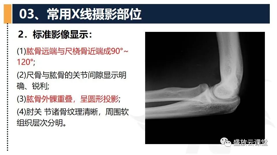 影像PPT - 【PPT】数字X线摄影检查（二）-32