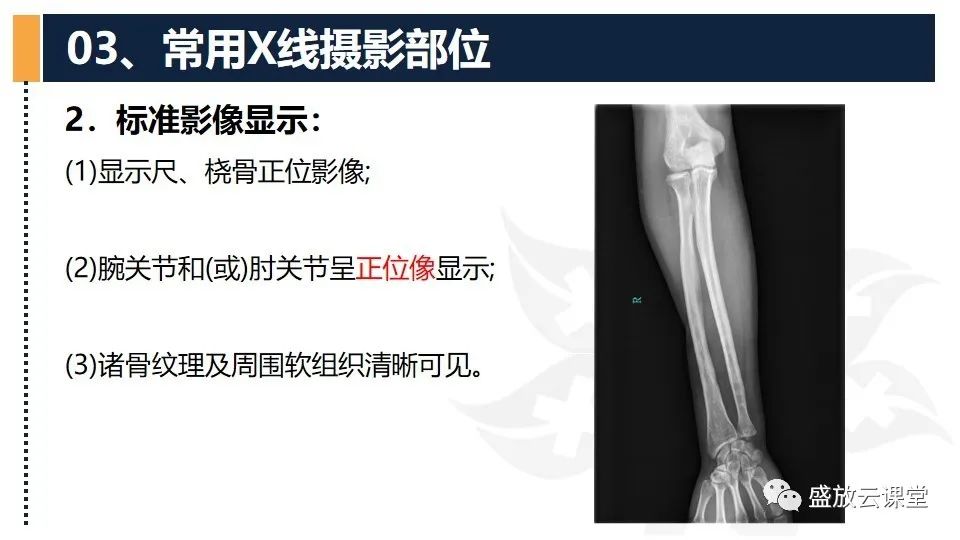 影像PPT - 【PPT】数字X线摄影检查（二）-34