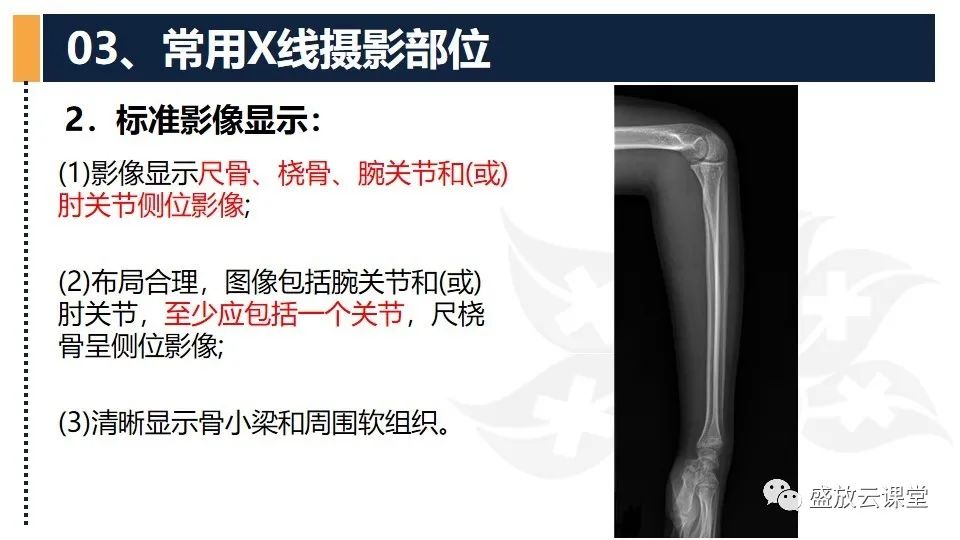 影像PPT - 【PPT】数字X线摄影检查（二）-36