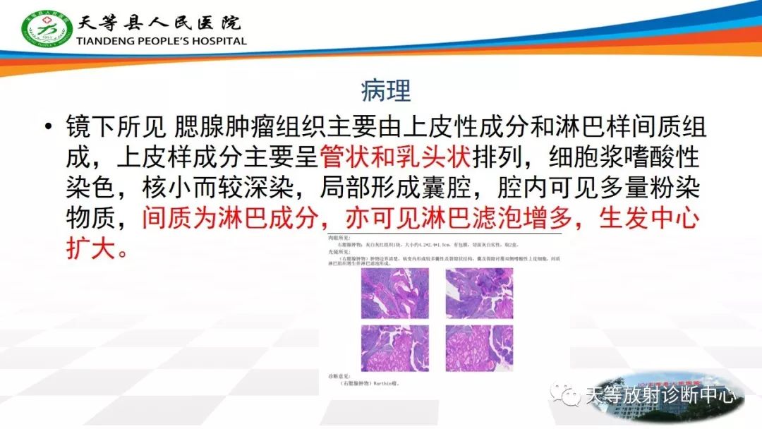 影像PPT - 【病例】腮腺腺淋巴瘤Warthin瘤1例MR影像-11 影像PPT - 【病例】腮腺腺淋巴瘤Warthin瘤1例MR影像-11