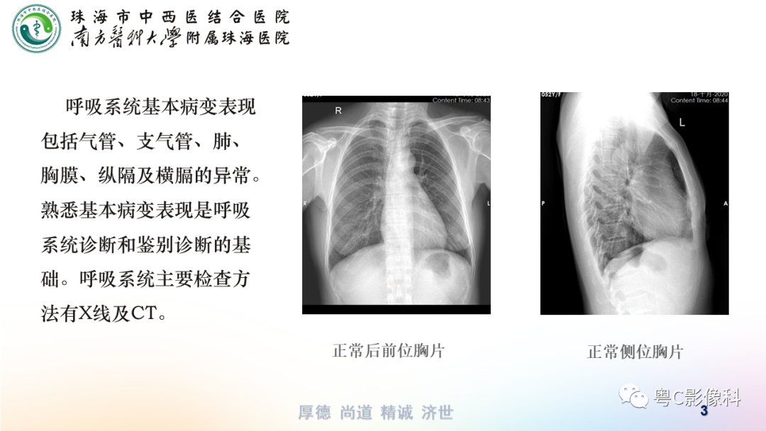 影像PPT - 【PPT】呼吸系统基本病变影像学表现-3