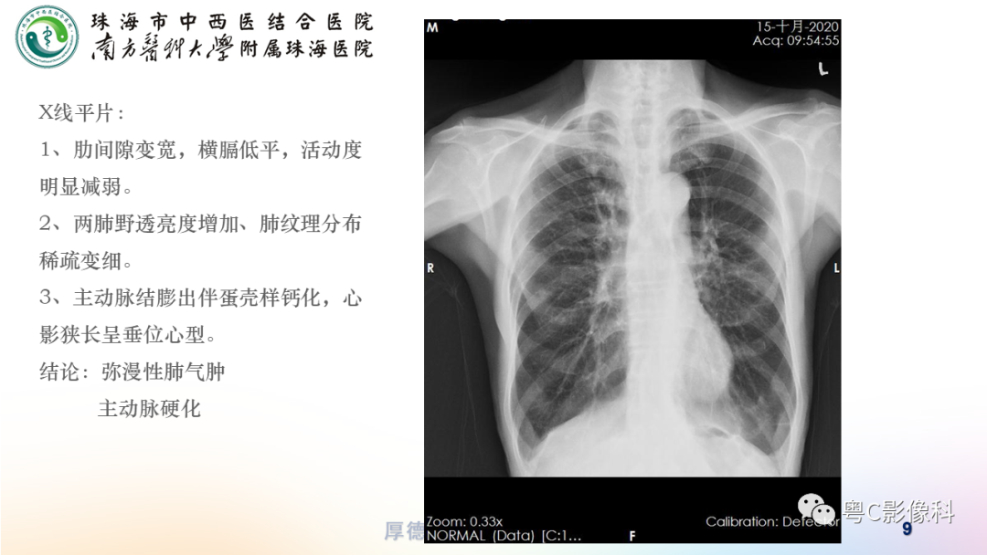 影像PPT - 【PPT】呼吸系统基本病变影像学表现-9