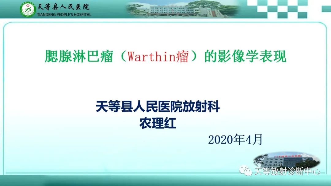 影像PPT - 【PPT】腮腺淋巴瘤(Warthin瘤)的影像学表现-1 影像PPT - 【PPT】腮腺淋巴瘤(Warthin瘤)的影像学表现-1