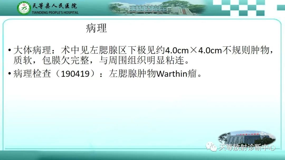 影像PPT - 【PPT】腮腺淋巴瘤(Warthin瘤)的影像学表现-6 影像PPT - 【PPT】腮腺淋巴瘤(Warthin瘤)的影像学表现-6