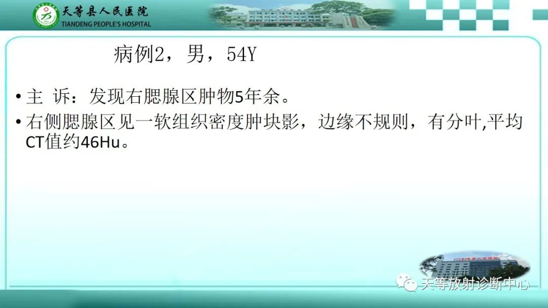 影像PPT - 【PPT】腮腺淋巴瘤(Warthin瘤)的影像学表现-7 影像PPT - 【PPT】腮腺淋巴瘤(Warthin瘤)的影像学表现-7