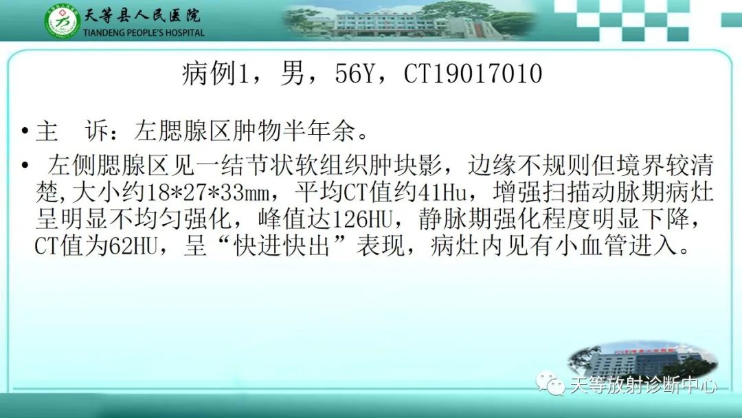 影像PPT - 【PPT】腮腺淋巴瘤(Warthin瘤)的影像学表现-3 影像PPT - 【PPT】腮腺淋巴瘤(Warthin瘤)的影像学表现-3