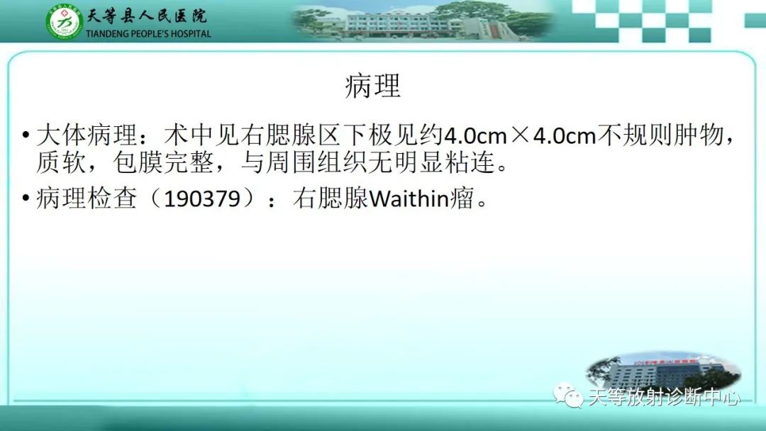 影像PPT - 【PPT】腮腺淋巴瘤(Warthin瘤)的影像学表现-17 影像PPT - 【PPT】腮腺淋巴瘤(Warthin瘤)的影像学表现-17
