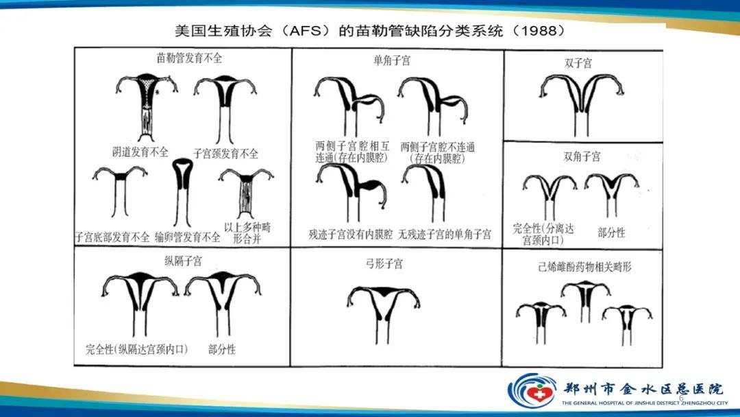 影像PPT - 【PPT】先天性子宫畸形分型及影像表现-6