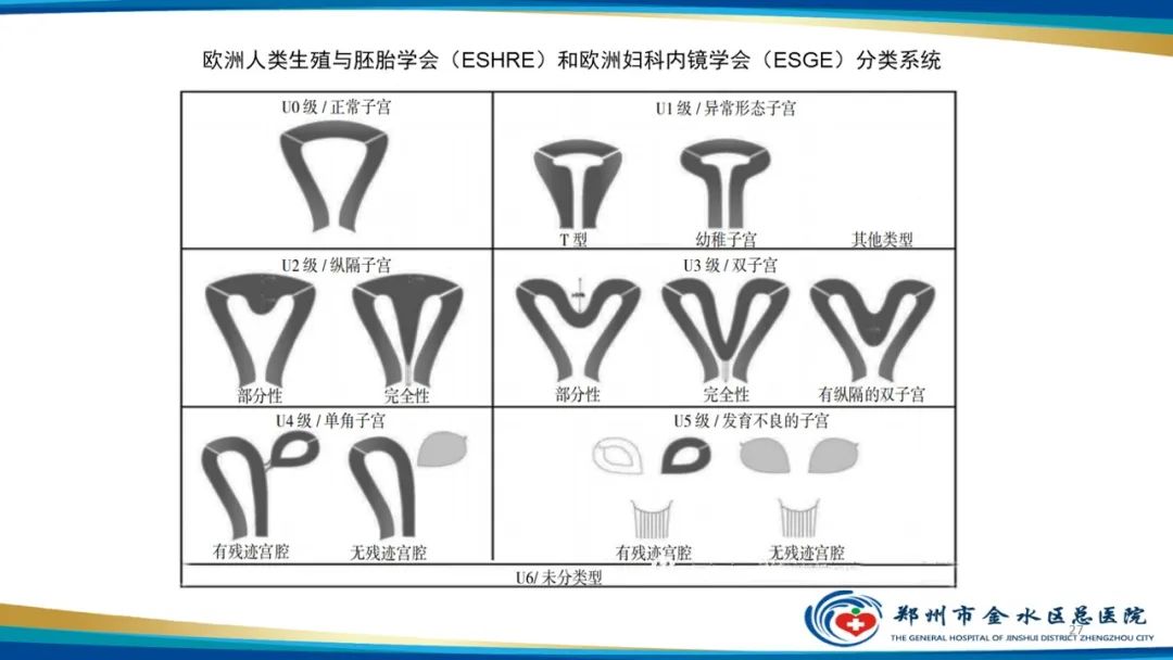 影像PPT - 【PPT】先天性子宫畸形分型及影像表现-27