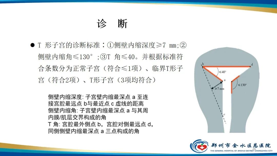 影像PPT - 【PPT】先天性子宫畸形分型及影像表现-26