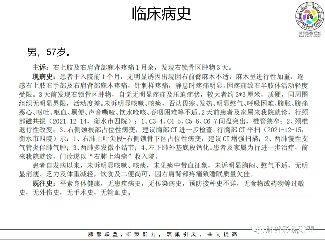 影像PPT - 【病例】癌肉瘤1例CT影像-2 影像PPT - 【病例】癌肉瘤1例CT影像-2