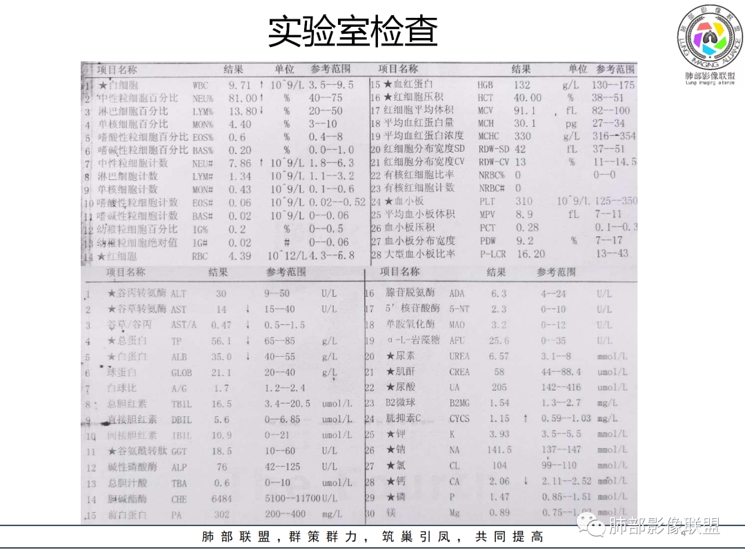影像PPT - 【病例】癌肉瘤1例CT影像-4 影像PPT - 【病例】癌肉瘤1例CT影像-4