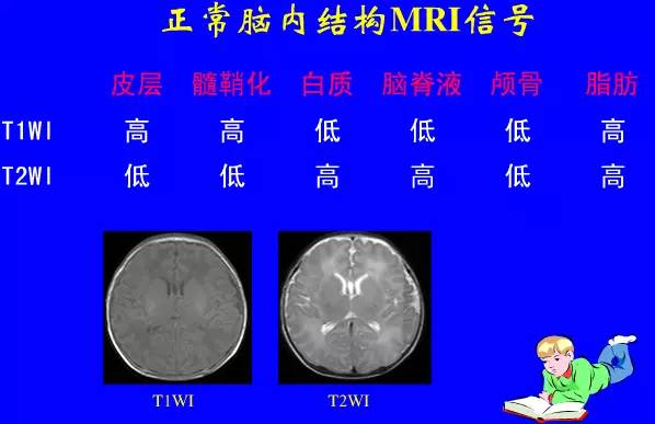 影像PPT - 【PPT】新生儿头部核磁共振成像-3