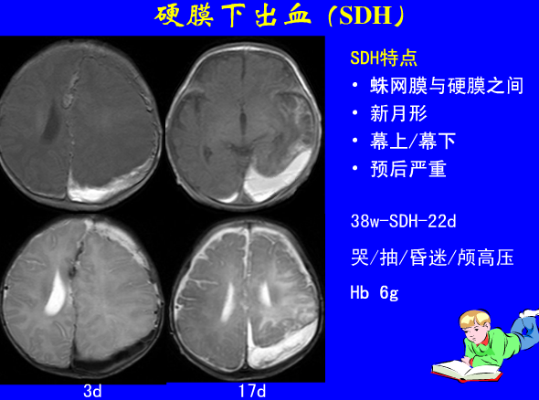 影像PPT - 【PPT】新生儿头部核磁共振成像-9