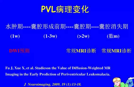 影像PPT - 【PPT】新生儿头部核磁共振成像-19