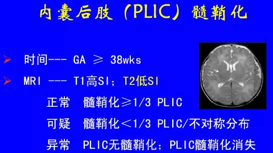 影像PPT - 【PPT】新生儿头部核磁共振成像-24