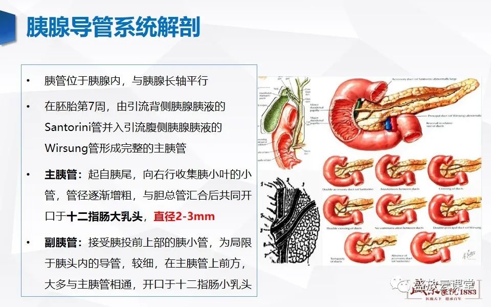 影像PPT - 【PPT】胰管增宽影像表现及意义-3